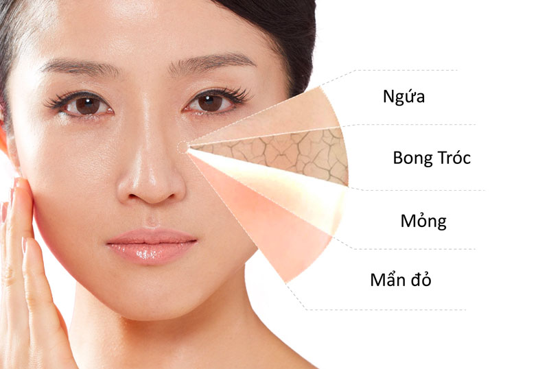 Cách chọn Mỹ phẩm chăm sóc da cho làn da nhạy cảm